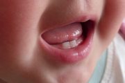 درمان های خانگی برای آرام کردن درد دندان کودک