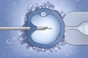 بررسی ارتباط فاکتورهای آنالیز اسپرم با پیامد درمان ناباروری به روش تزریق داخل سیتوپلاسمی اسپرم (ICSI)