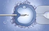 بررسی ارتباط فاکتورهای آنالیز اسپرم با پیامد درمان ناباروری به روش تزریق داخل سیتوپلاسمی اسپرم (ICSI)