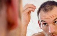 نکاتی برای قبل و بعد از جراحی پیوند موی طبیعی