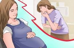 سوالات رایج در مورد تهوع بارداری