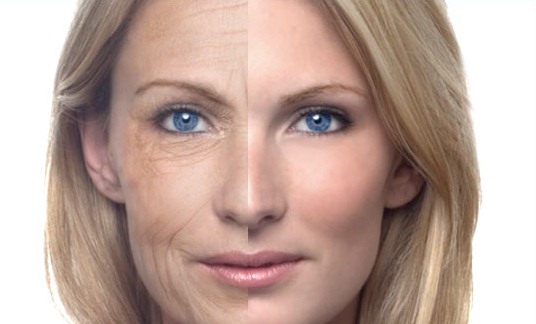 get-rid-of-wrinkles